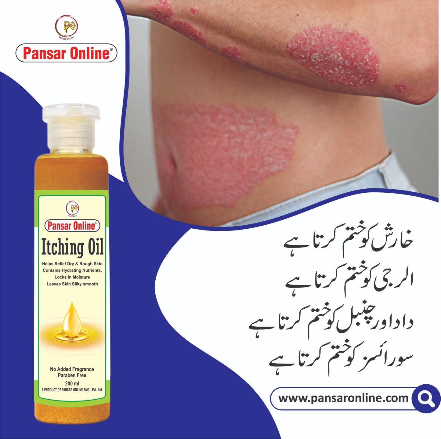 Itching Oil-(For Dry Itchy Skin)